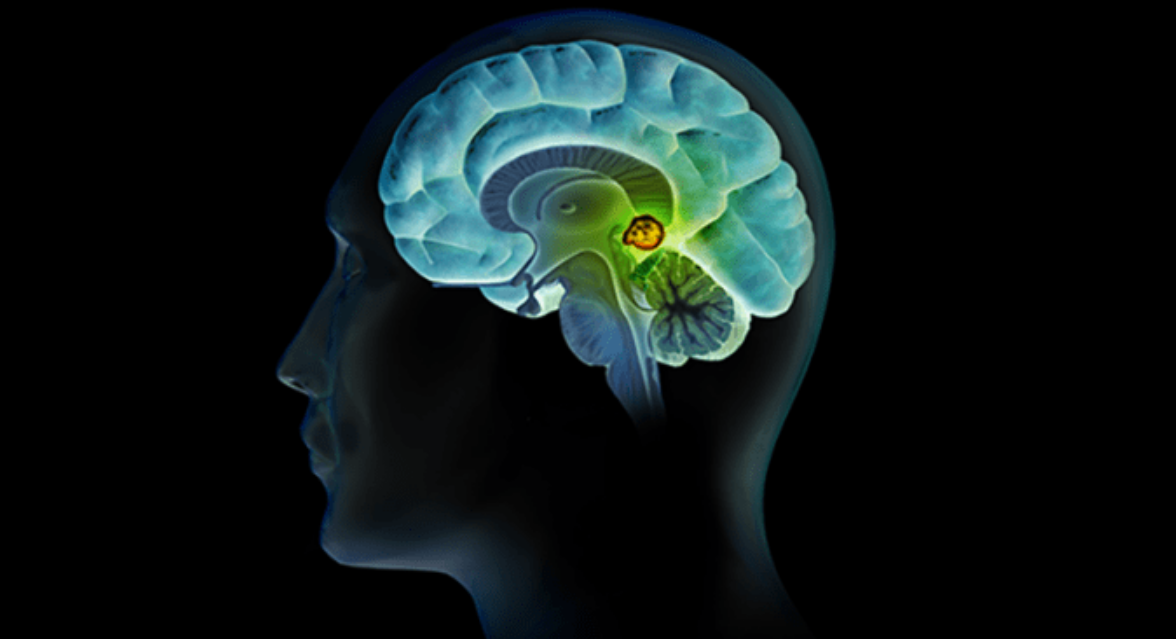 Chụp MRI chẩn đoán bệnh