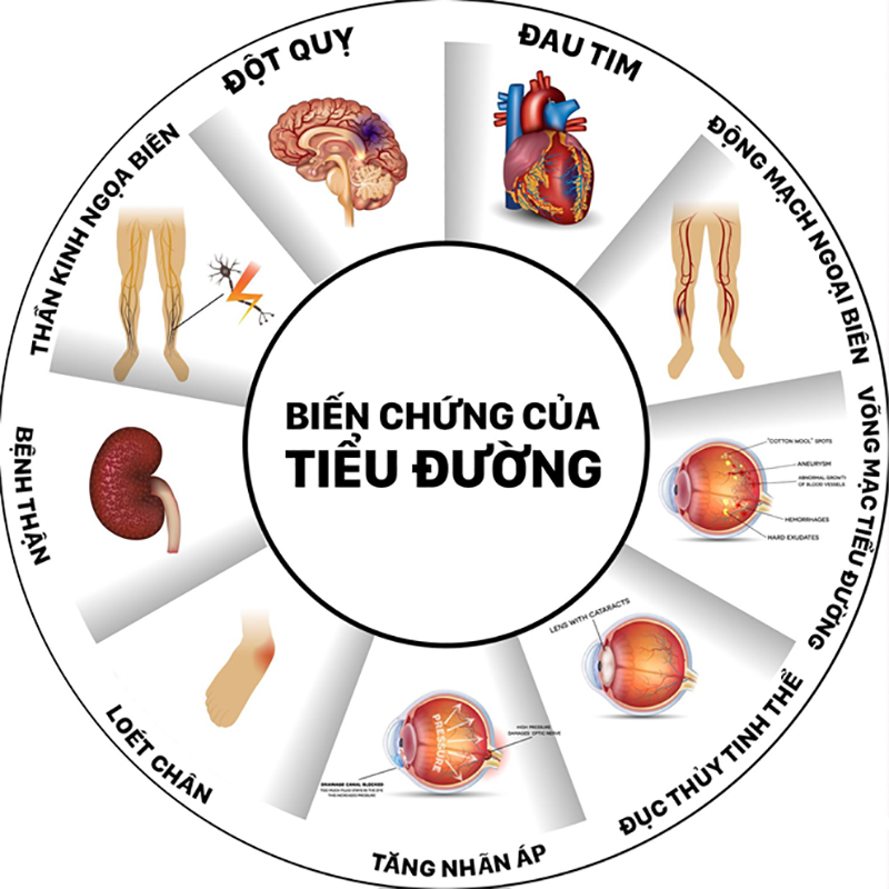 Tiểu đường tuýp 2 có rất nhiều biến chứng