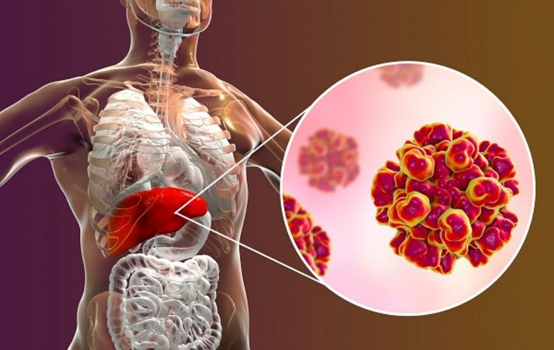 Cách phòng ngừa viêm gan - Bảo vệ sức khỏe của bạn khỏi mối đe dọa nguy hiểm