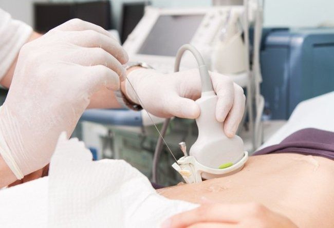 Cách tìm hiểu ung thư sớm bằng kiểm tra định kỳ và sàng lọc