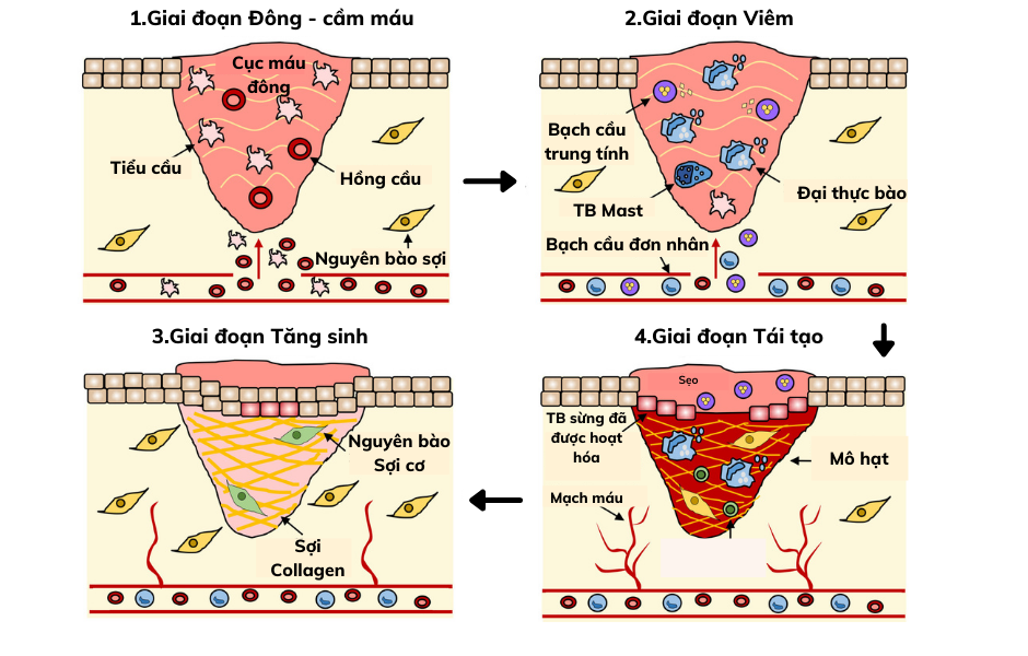 Các Đại thực bào sẽ đến và tiêu diệt các mô hoại tử, vi khuẩn và vật lạ nhằm làm sạch vết thương, chuẩn bị cho giai đoạn Tăng sinh tiếp theo