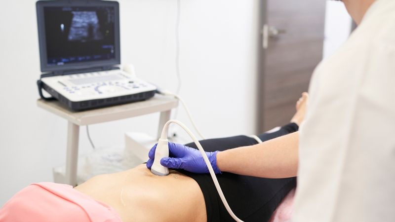Chẩn đoán hình ảnh hỗ trợ xác định kích thước và cấu trúc của khối u buồng trứng