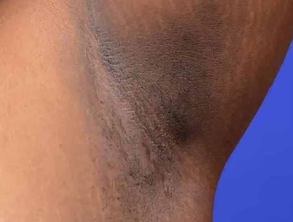 Đối tượng nguy cơ