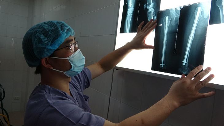 Phát hiện gãy xương nhờ phương pháp chụp X-quang