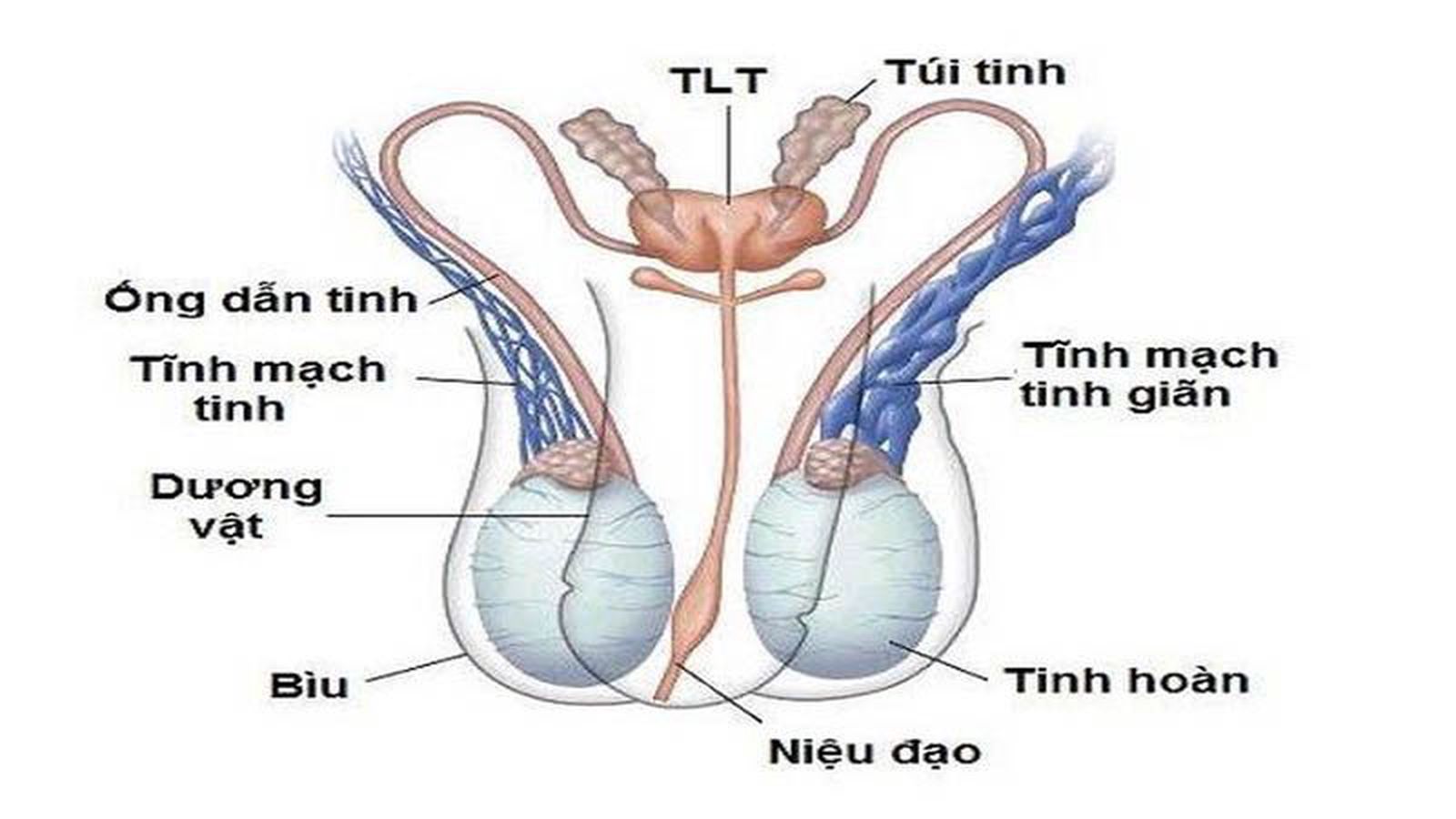 Giãn tĩnh mạch thừng tinh