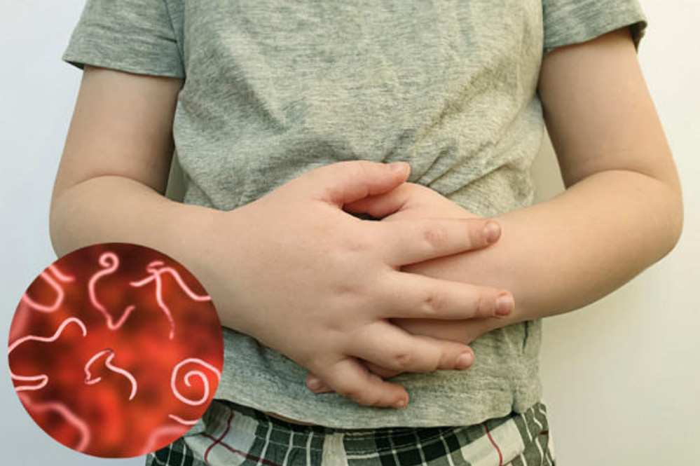 Giun sán có thể gây rối loạn tiêu hóa, táo bón hoặc tiêu chảy