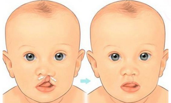 Có thể phẫu thuật điều trị bệnh