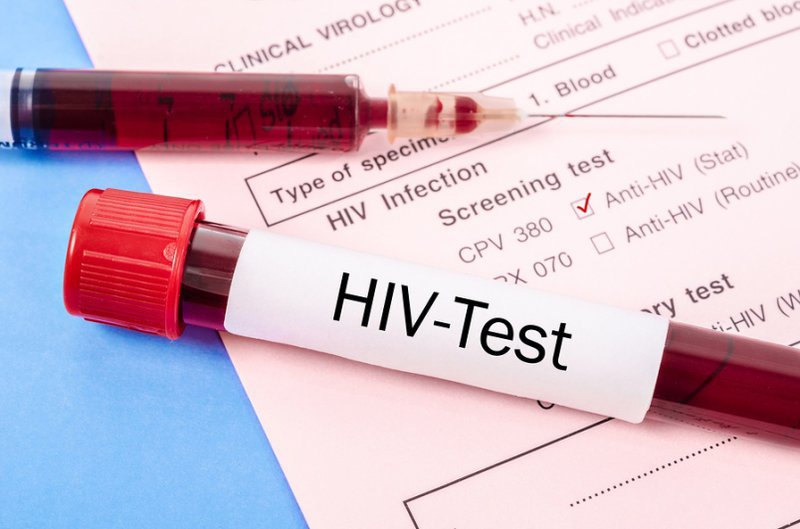 Xét nghiệm HIV khi nghi ngờ tiếp xúc với nguồn lây bệnh