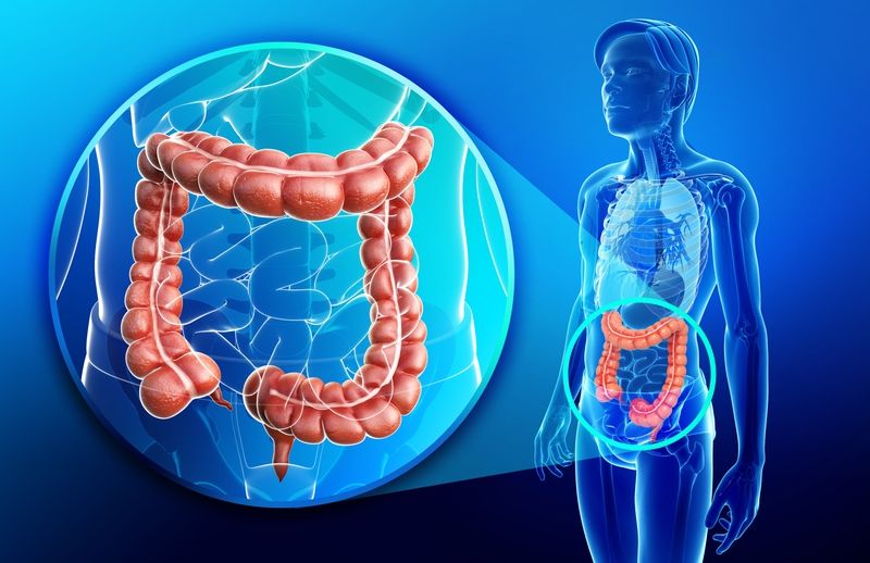 Việc tầm soát sớm giúp phát hiện các polyp tiền ung thư để can thiệp kịp thời 