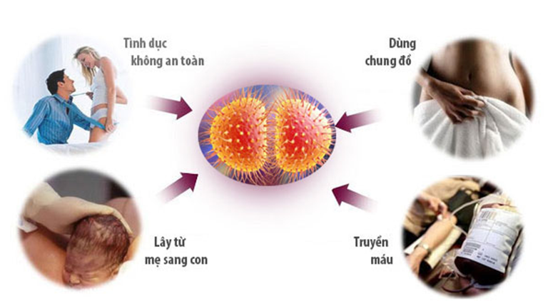 Những thông tin về bệnh lậu mà bạn cần biết