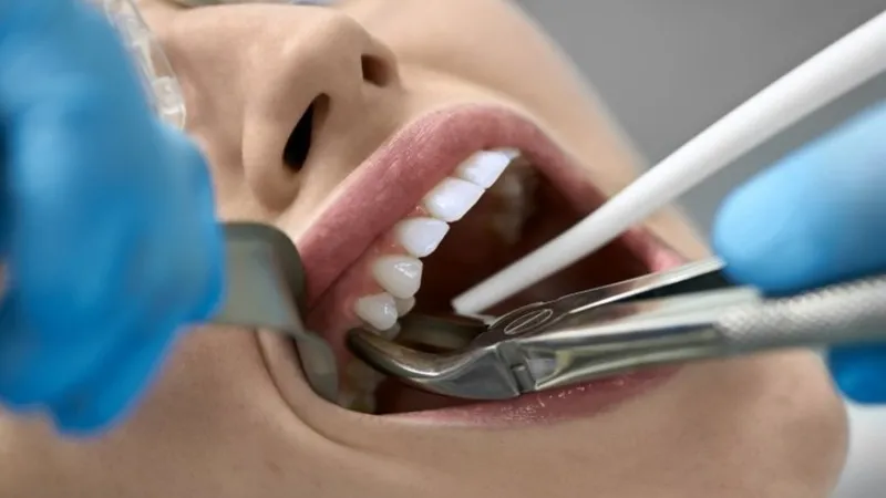 Hình minh họa vấn đề về răng ở người tiểu đường