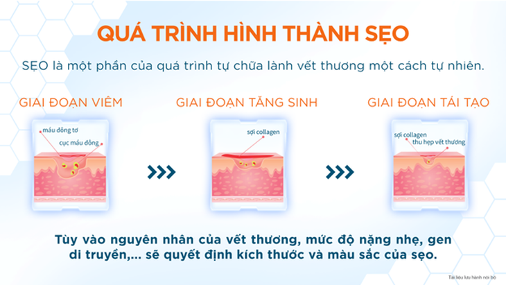 Sẹo là một phần tự nhiên của quá trình lành bệnh