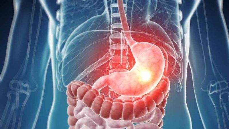 Các bệnh lý đường tiêu hóa có thể là nguyên nhân dẫn đến xuất huyết tiêu hóa