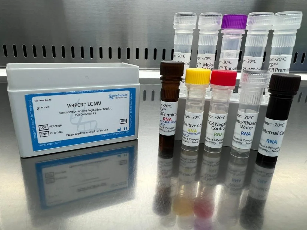 Hình ảnh số lượng tế bào máu tổng cộng để chẩn đoán viêm màng não lympho bào