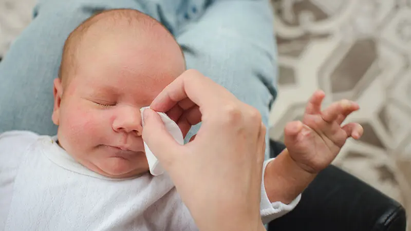 Vệ sinh đúng cách giúp giảm thiểu tình trạng bệnh mắt ở trẻ sơ sinh.