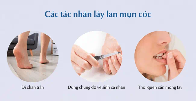 Tác nhân khiến lây nhiểm bệnh