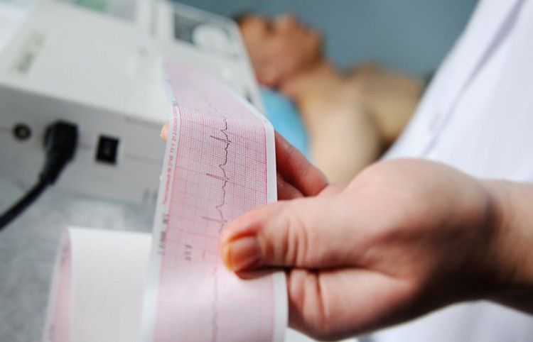 Theo dõi nhịp tim thường xuyên là cách tốt nhất để nhận biết các dấu hiệu nguy hiểm của block tim - Biến chứng block nhĩ thất độ 3 có thể xảy ra