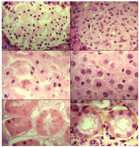 Triệu chứng gây ra bởi bệnh mô bào Langerhans phụ thuộc vào vị trí và mức độ liên quan