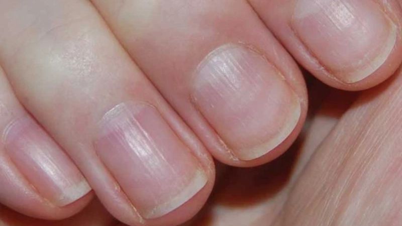 Hình ảnh minh họa các phương pháp chăm sóc và dưỡng ẩm giúp cải thiện tình trạng xước măng rô hiệu quả