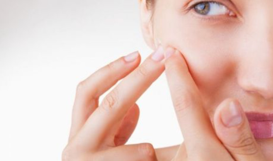 Không nên tự ý nặn mụn ẩn