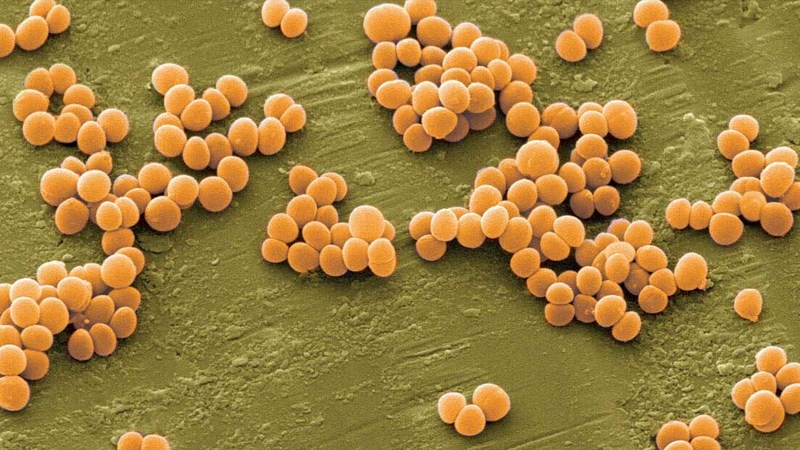 Tụ cầu Staphylococcus aureus là nguyên nhân phổ biến gây áp xe dưới da