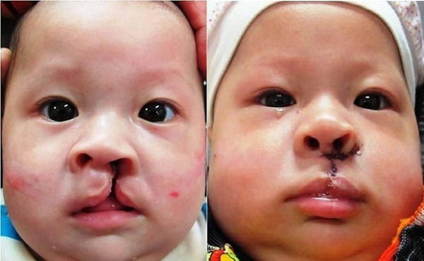 Sự thấu hiểu và đồng hành của gia đình là nguồn sức mạnh lớn nhất đối với những đứa trẻ đặc biệt 