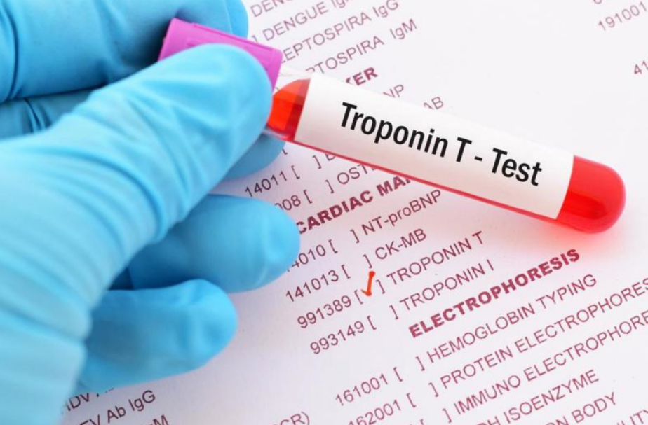 Xét nghiệm nhồi máu cơ tim: Troponin T - Test