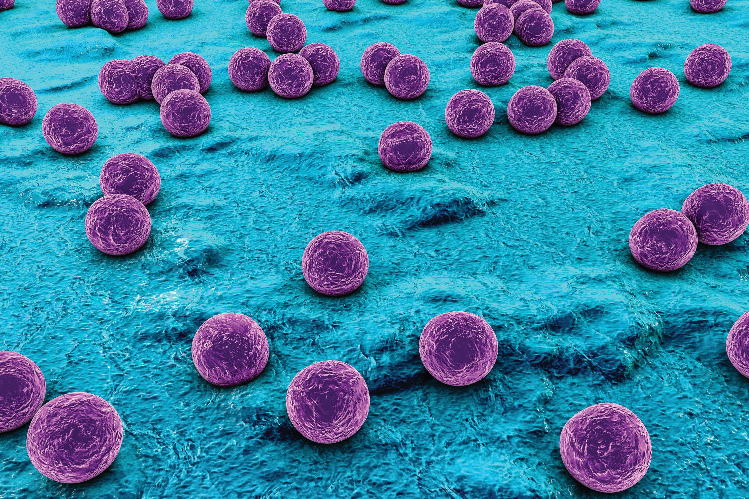 Vi khuẩn Staphylococcus aureus gây nhiễm trùng.