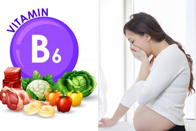 Vitamin B6 là thuốc điều trị không cần kê đơn và được ưu tiên sử dụng