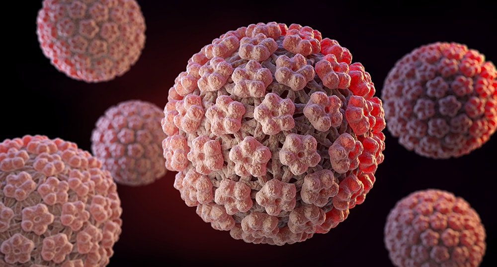 Virus HPV gây bệnh papilloma thanh quản