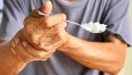 Run tay là dấu hiệu dễ nhận biết nhất của bệnh Parkinson