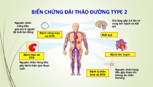 Đái tháo đường tuýp 2 có thể gây ra các biến chứng nguy hiểm