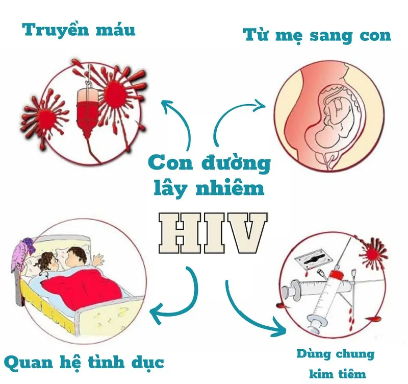 HIV không nằm trong danh mục các bệnh bị cấm làm việc trong ngành hàng không 