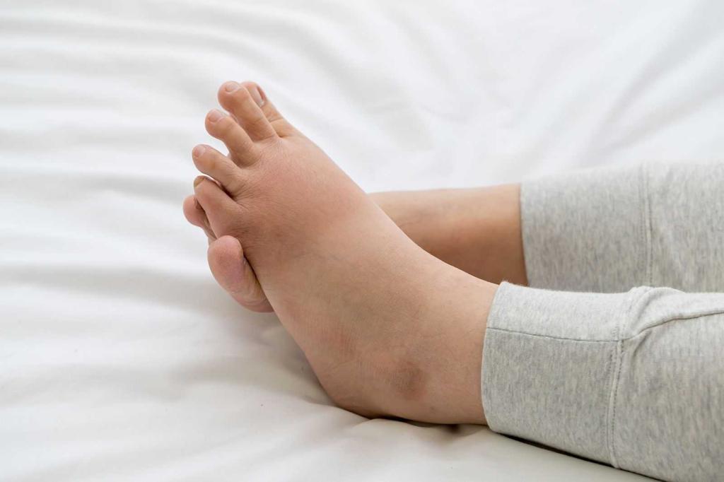 Phụ nữ có thai bị phù chân có nguy hiểm không?