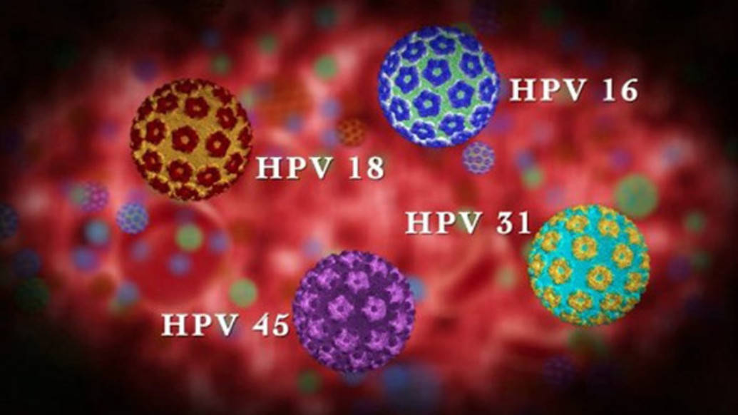 Virus HPV là tác nhân chính gây bệnh ung thư biểu mô cổ tử cung