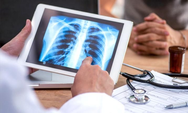 Tầm soát ung thư phổi với bác sĩ để kịp thời phát hiện và điều trị
