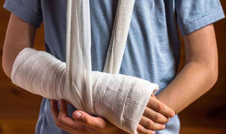 Bó bột điều trị rạn xương