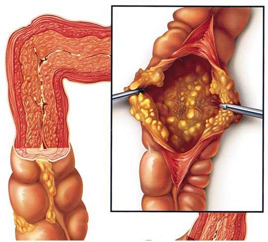 Tầm quan trọng của việc thăm khám định kỳ