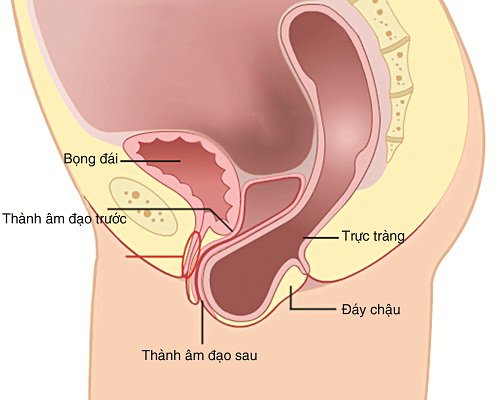 Sa tử cung kéo theo sa trực tràng khiến sản phụ bị táo bón nghiêm trọng hơn cả khi mang thai