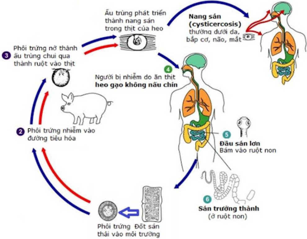 Nguyên nhân nhiễm ấu trùng sán lợn