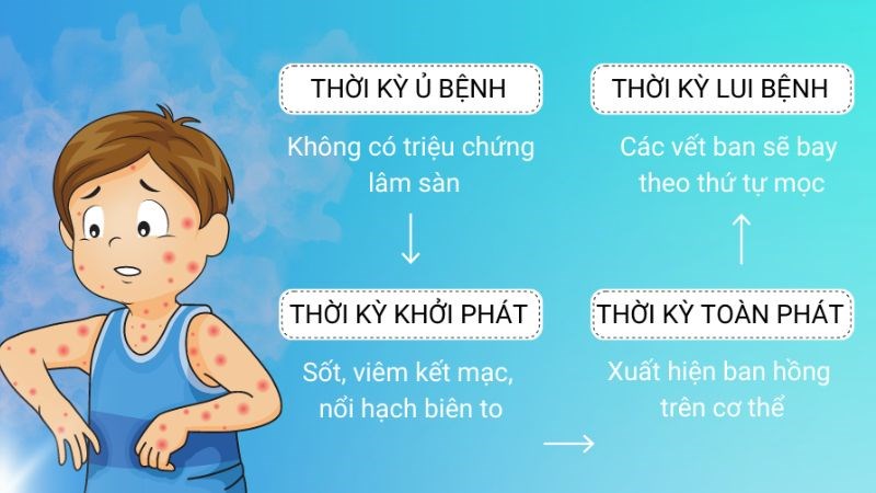 Biểu hiện các giai đoạn bệnh sởi