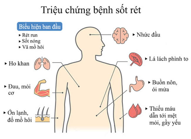 Các biến chứng nguy hiểm của bệnh sốt rét