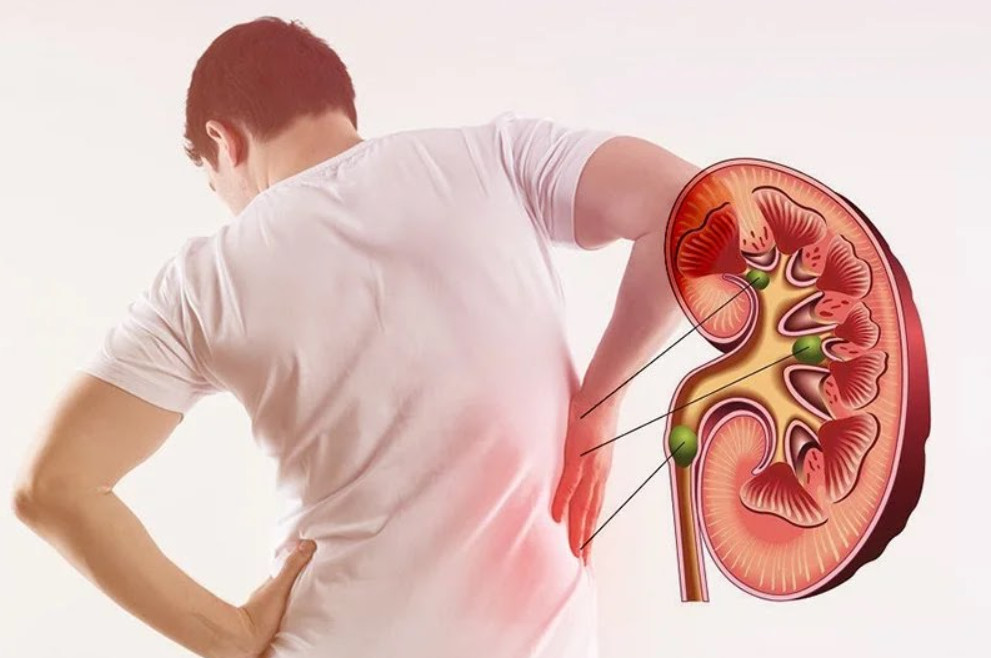 Dấu hiệu nhận biết suy thận giai đoạn cuối - Pharmacity