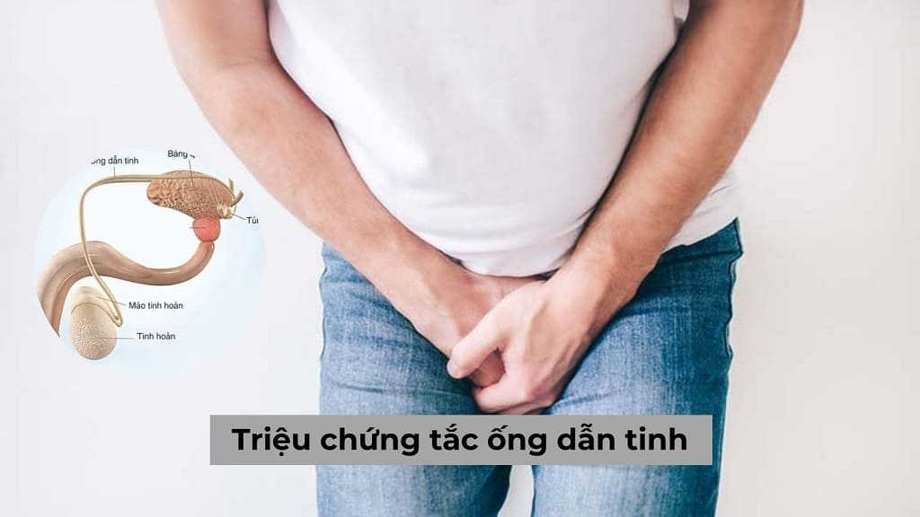 Cảm giác căng tức khó chịu khi nắn vào vị trí ống dẫn tinh là một trong các dấu hiệu của bệnh