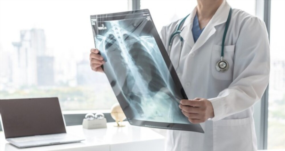 Chẩn đoán tăng áp phổi bằng phương pháp chụp X quang phổi