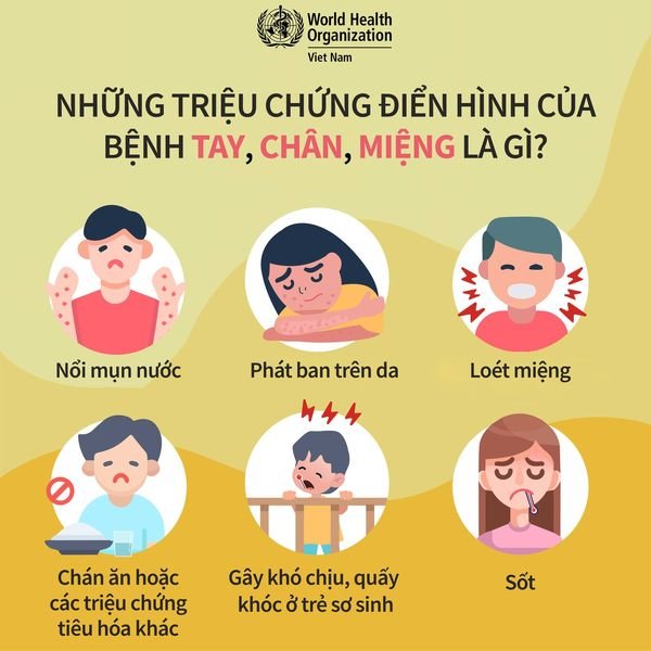 Triệu chứng bệnh tay chân miệng