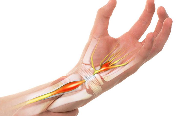 Tê bì: nguyên nhân vấn đề sức khỏe và cách đối phó hiệu quả
