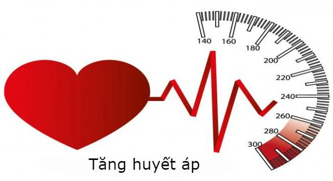 Tăng huyết áp có thể là biểu hiện của thận đa nang