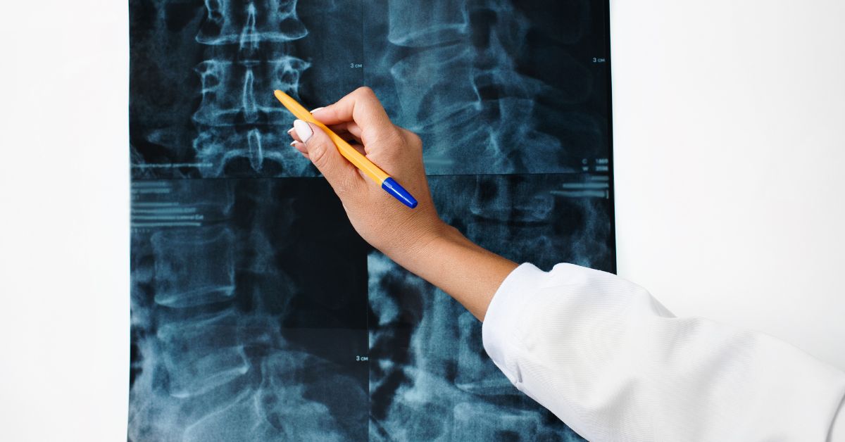 Bác sĩ sẽ chỉ định thêm các phương pháp chẩn đoán hình ảnh như chụp X-quang, CT scan, MRI