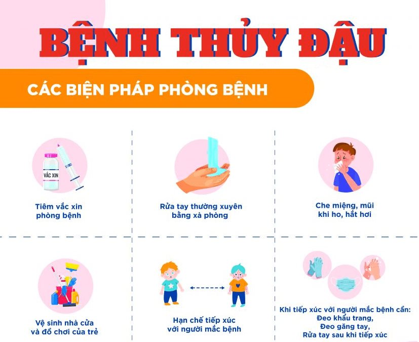 Các biện pháp phòng ngừa thủy đậu